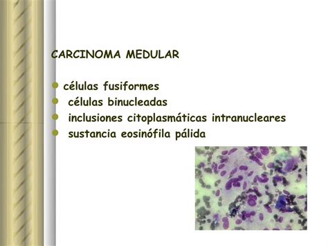 Pdf Citolog A Tiroidea Lesion Folicular Endosuem Org Uy Wp Content