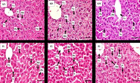 Histological Section Of Liver Of Diabetic Mice After Mangosteen