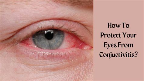 How To Protect Your Eyes From Conjunctivitis Technology Vista