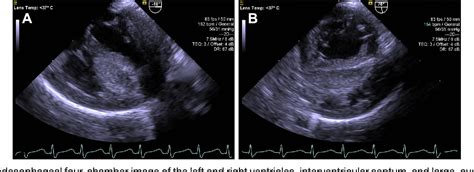 Figure From Diagnosis And Observational Management Of A Postoperative