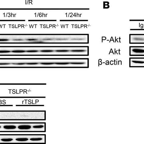 Tslp Activates The Pi K Akt Pathway In Liver I R Injury A Western