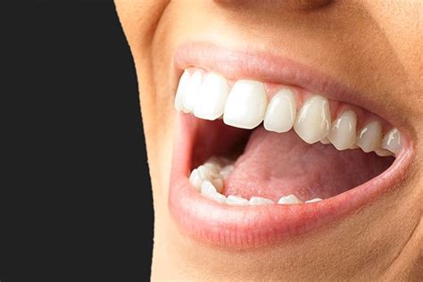 Gum Tissue Grafting What You Need To Know Smilefocus Dentist Singapore