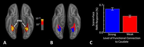 Panel A Shows The Group Averaged N43 Cortical Activity Map Evoked By