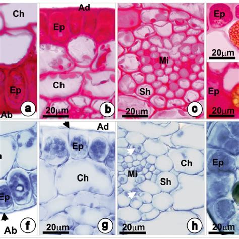 Photomicrographs Of Transverse Sections Of The Leaf Blade Of Halodule Download Scientific