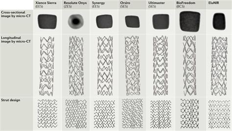 Drug Eluting Coronary Stents Insights From Preclinical And Pathology