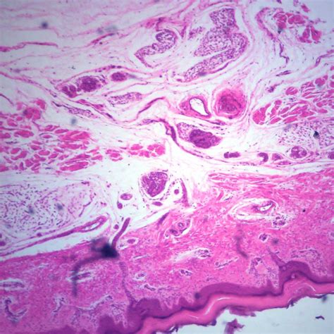 Human Skin showing sweat glands - Southern Biological