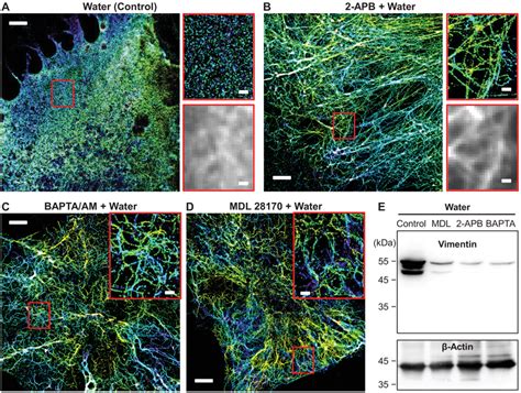 Inhibition Of Calpain Activity Or Intracellular Calcium Release