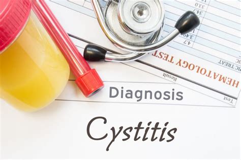 Causes, Symptoms, Treatments of Dysuria - Facty Health