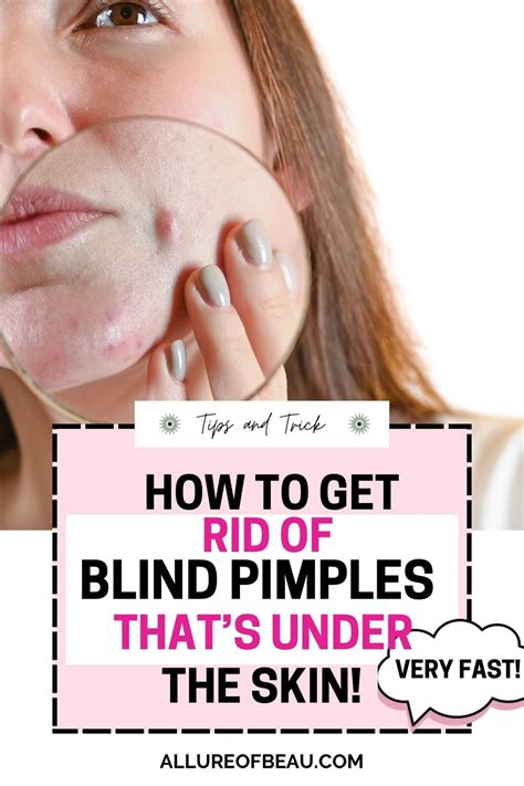 How To Get Rid Of Blind Pimple Artofit