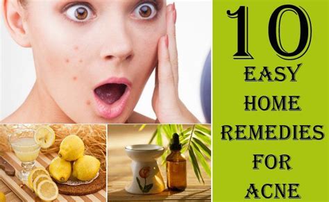 Simple Home Remedies To Help Acne Acne Aid Solution