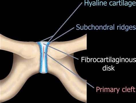 Imaging Of The Pubic Symphysis Anatomy And Pathologic Conditions