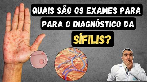 Plexo Pampiniforme Dr Lucas Felipe Gomes Urologista