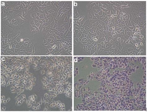 Microscopic Image Of Hela Cell A After Incubation Control Dish Cell