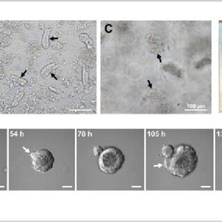 Generation Of Mouse Small Intestinal Organoids A Crypts Prepared By