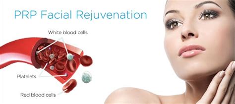 Platelet Rich Plasma Prp Skin Rejuvenation Surgery In Peru