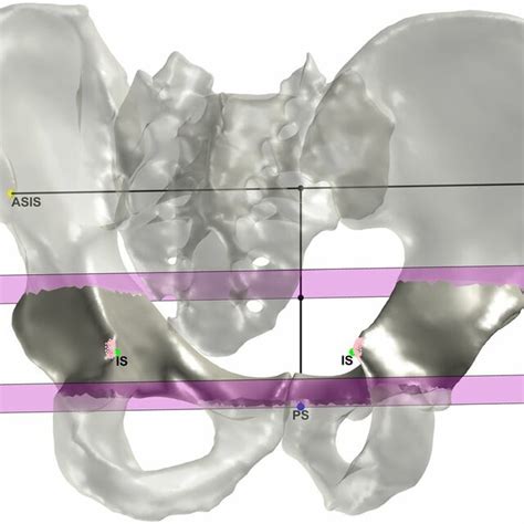 The Pelvis In The APP Coordinate System The APP And ASISs Are Depicted