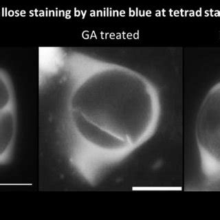 Callose staining by aniline blue at tetrad stage | Download Scientific ...