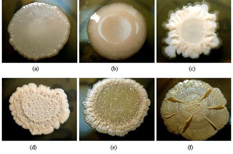 The Shapes Of The Isolated Colonies A Round B Round With A Ridge