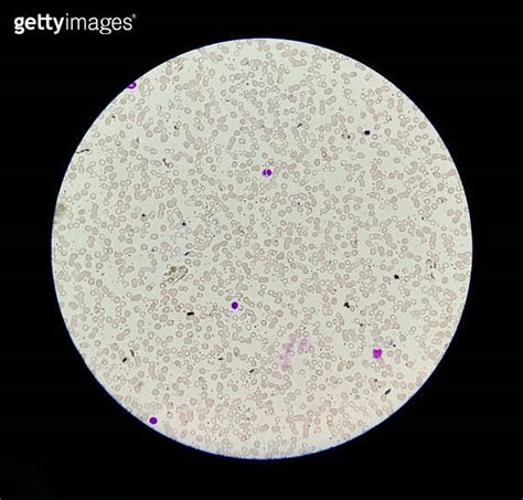 Hematology Blood Smear Leishman Stain Under Light Microscope Show