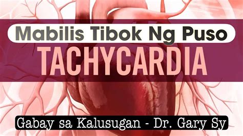 Tachycardia Dr Gary Sy Youtube