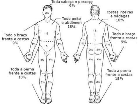 Medicina facilitando fontes ASSISTÊNCIA AO GRANDE QUEIMADO