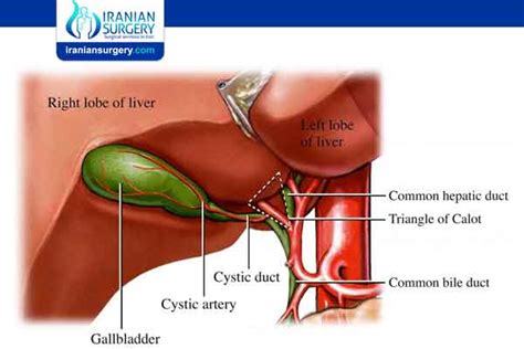 cholecystectomy complications | symptoms of a bile leak after gallbladder