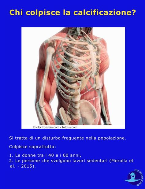 Calcificazione Alla Spalla Le Cause I Sintomi E La Fisioterapia