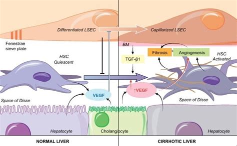 The Role of Hepatic Sinusoidal Endothelial Cells In Case of Liver Diseases