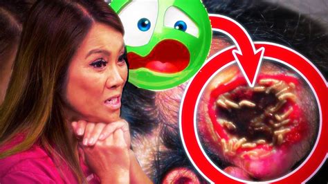 Ranking The Most Disgusting Dr Pimple Popper Moments🤮 Youtube