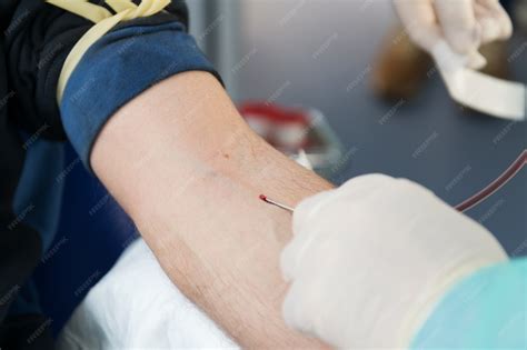Sangue Preto Na Veia - Insere uma agulha na veia, close-up, preparação para fazer exame de ...
