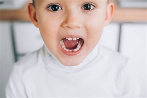 El niño muestra los dientes abriendo la boca entre los dientes del