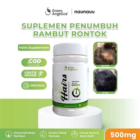 Jual Saw Palmeto Green Angelica Suplemen Penumbuh Rambut Kapsul