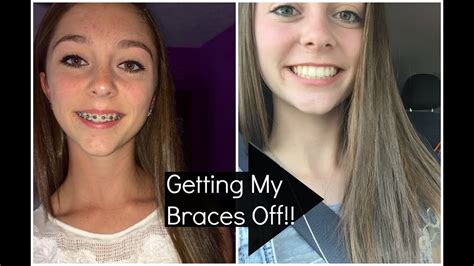 Getting My Braces Off Vlog Youtube