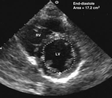 Bedside Ultrasonography Clinical Gate