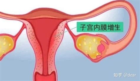 如何备孕子宫内膜薄还是厚，内膜薄受孕难不难？ 知乎