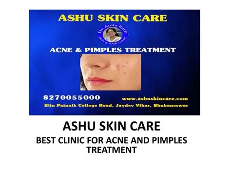 Ppt Ashu Skin Care Is Best Clinic For All Type Of Skin Problems In