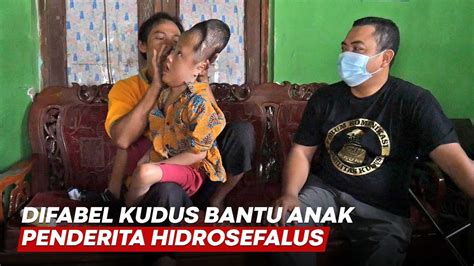 Ulil Albab Bocah 7 Tahun Penderita Hidrosefalus Di Kudus YouTube