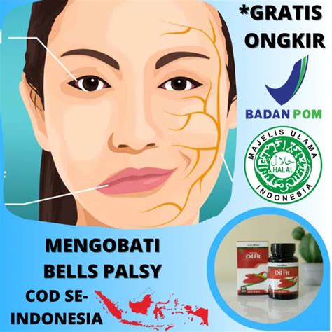 Obat Bells Palsy Herbal Penyakit Bells Palsy Mengobati Struk Di Wajah