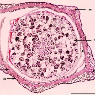 Achene And Pappus Structures Of Caucasoseris Abietina Prenanthes