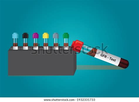 Blood Sample Glomerular Filtration Rate Gfr Stock Vector Royalty Free