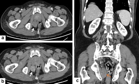 Gastroenterol Res