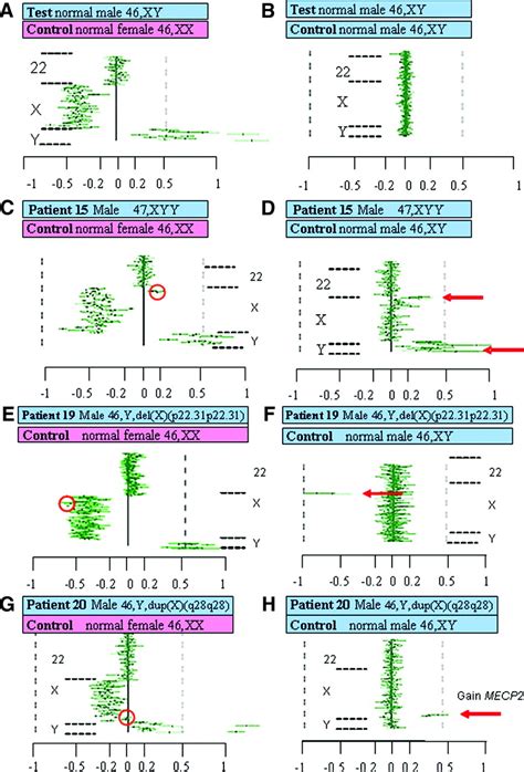 Microarray Based Comparative Genomic Hybridization Using Sex Matched Reference Dna Provides