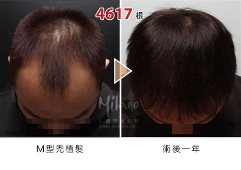 drmilano