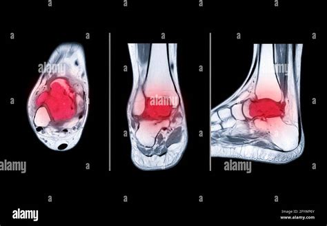 El Plano Coronal Y El Plano Axial Fotos e Imágenes de stock Alamy