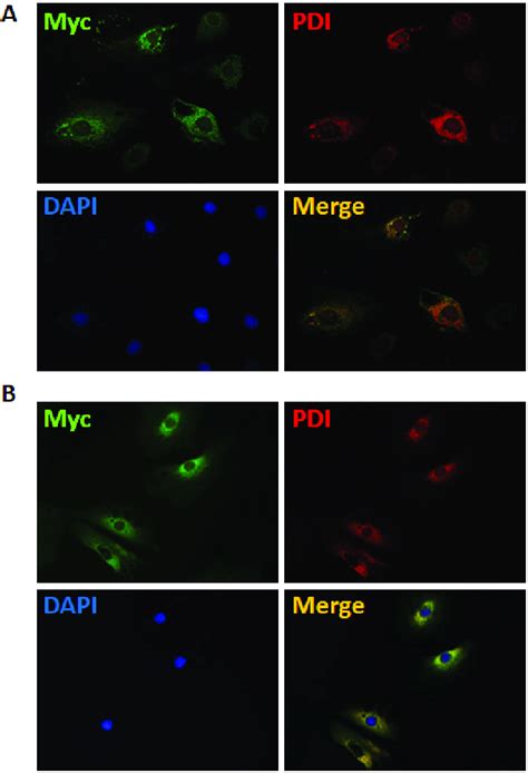 Localization Of Mutant Peripheral Myelin Protein 22 Pmp22 And Myelin