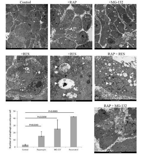 Arpe 19 Cell Treated By Autophagy Inducer Rapamycin Rap 100 Nm