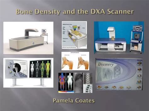 PPT - Bone Density and the DXA Scanner PowerPoint Presentation, free download - ID:2077793