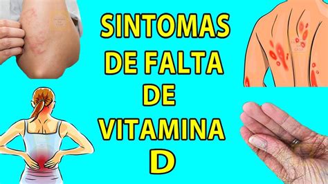 Sintomas De Falta De Vitamina D Que Nunca Devem Ser Ignorados Youtube