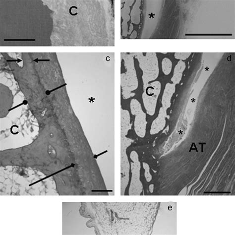 The histology of tuber calcanei. Arrow: the ceiling of the RB ...