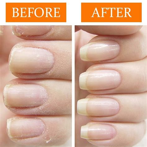 Healthy Nails